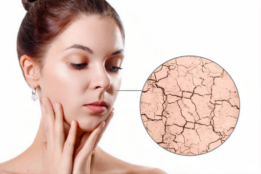 How to Transform Dry Skin: A Scientific Approach to Hydration & Glow
